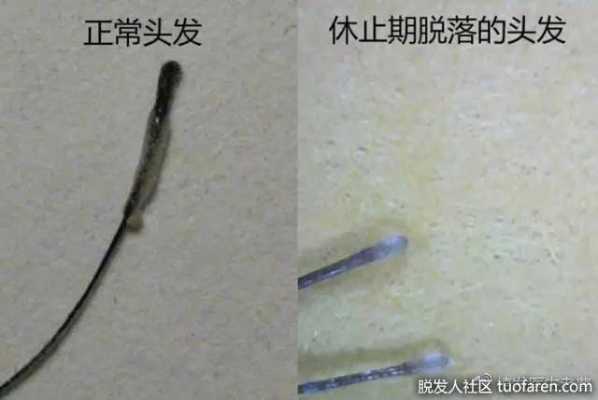 发根变硬的最好方法,发根很硬怎么办
