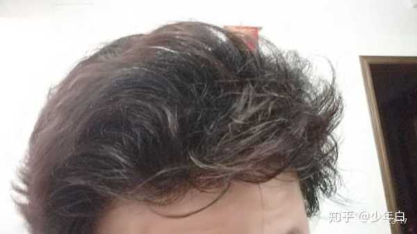 为什么发质越来越硬（什么是发质硬）