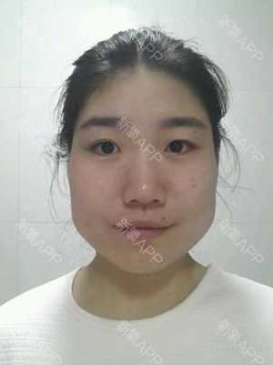 倒瓜子脸长什么样子（倒过来的瓜子脸是什么样子的）