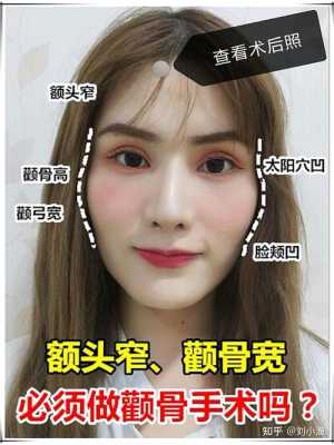 额头很宽怎么办（额头很宽怎么办女生）