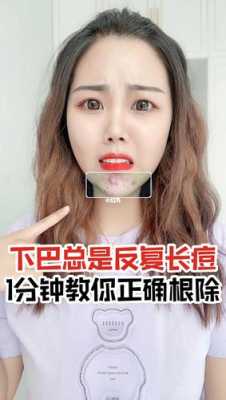 下颚长痘痘怎么解决（下巴痘痘去除小妙招）