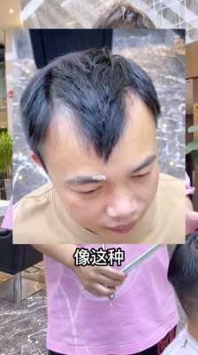m发型怎么办（m型发型怎么办）