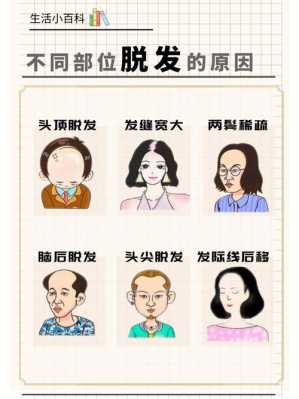 两鬓脱发是什么原因（两鬓脱发是什么原因引起的）