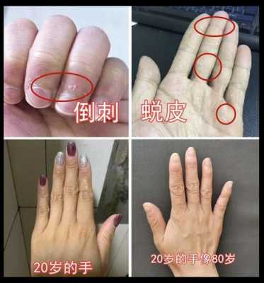 冬天手干燥粗糙还脏洗不干净,冬季手干燥粗糙怎么护理