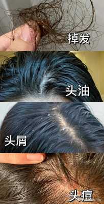 为什么有人头发长得快（为什么头发比别人干得快）
