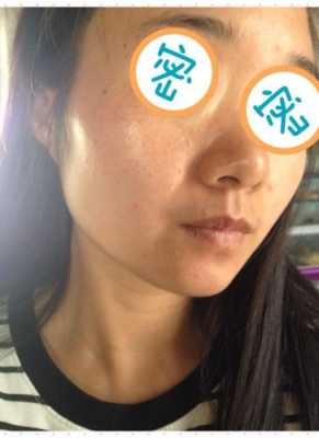 混合性皮肤是什么样的（混合性皮肤是什么样的状况）