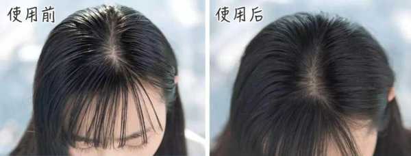怎么算油性发质（怎么算油性发质,怎么算干性）