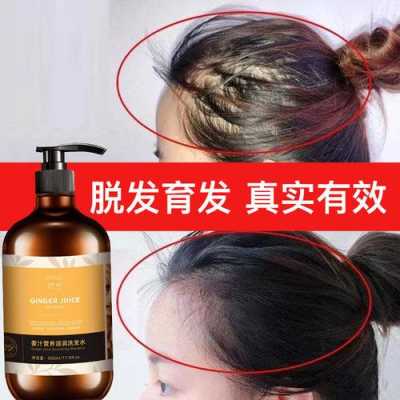 头发出油脱发用什么洗发水（头发出油而且掉头发挺严重用什么洗发水）
