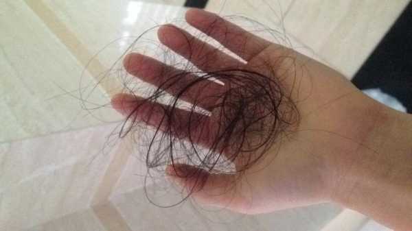 女生头发掉的厉害是什么原因（女生头发掉的厉害是什么原因怎么办）