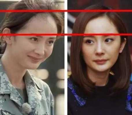 额头过高怎么办（发际线高怎么办）