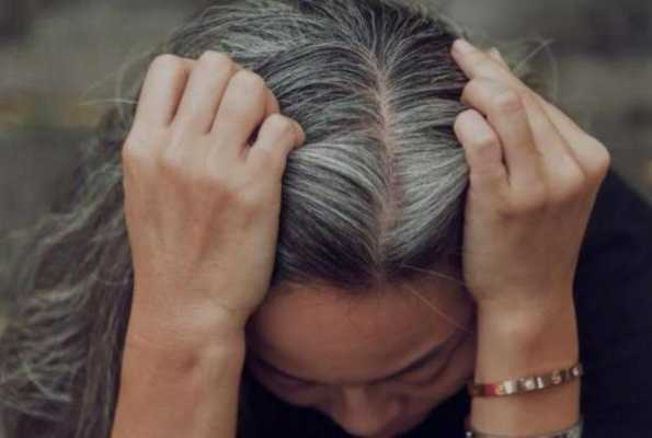 头发两侧白头发多是什么原因（两鬓白发怎么染好看）