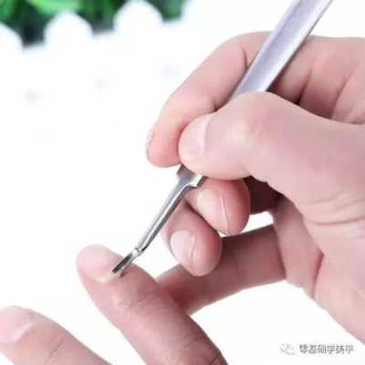 死皮挫怎么用（死皮叉的正确使用手法）