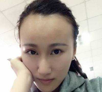 什么样的额头叫高额头,高额头是什么意思