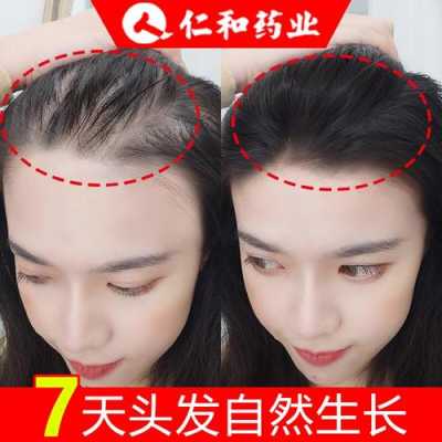 用什么生发快（头发如何长的快）