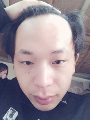 什么是额头大（额头多长才算大）