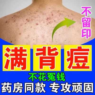 背部长痘痘怎么消除（后背长痘痘怎么消除用什么药）