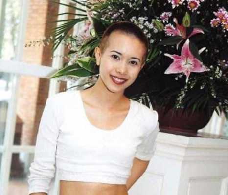谢顶适合留什么发型（谢顶适合留什么发型女）