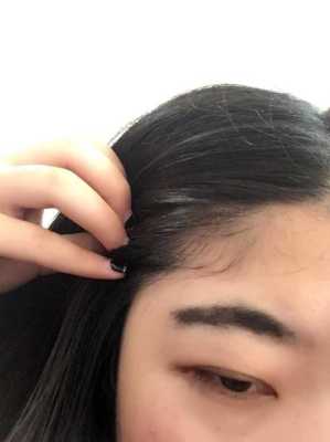 额头碎发太多怎么去除（额头碎发太多怎么去除小妙招）