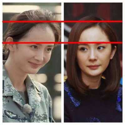 发际线为什么会后移,发际线为什么后移了