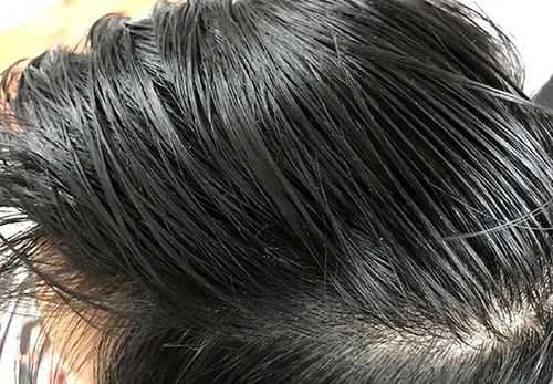 为什么头发会很油（为什么头发容易油）