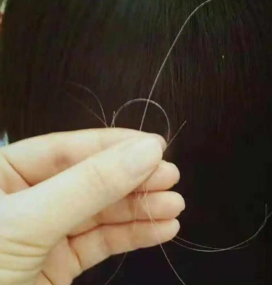满头白发怎么治（白头发越来越多有什么妙招）
