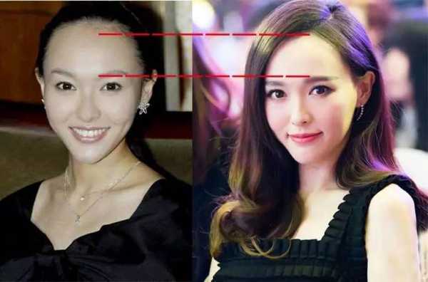 额头不好看怎么整（额头不好看怎么整发型）