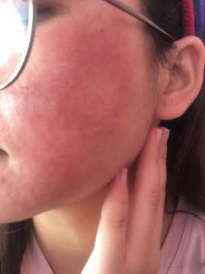 老人出现手肿，脸肿是什么原因,脸宽什么原因导致的