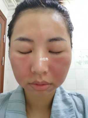 老人出现手肿，脸肿是什么原因,脸宽什么原因导致的