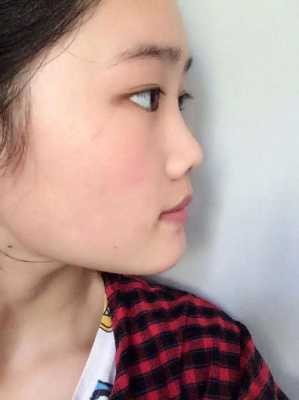 塌鼻梁是什么样子,什么是塌鼻梁图片女