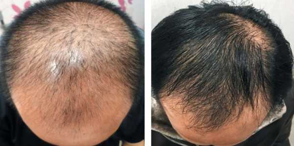 毛发发黄干燥怎么办（毛发发黄干燥怎么办小妙招）
