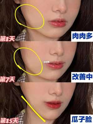 怎么区分圆脸和婴儿肥（怎么区分圆脸和婴儿肥脸）