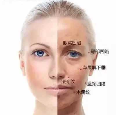 脸蛋皮肤松弛怎么办（感觉脸上皮肤松弛怎么办）