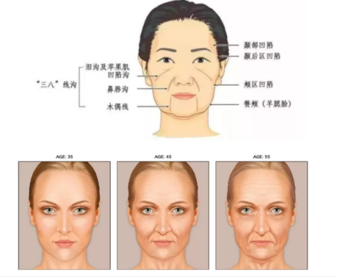 脸蛋皮肤松弛怎么办（感觉脸上皮肤松弛怎么办）
