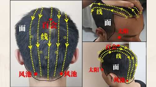 刮痧板刮头有什么好处,头发上刮什么图形好看