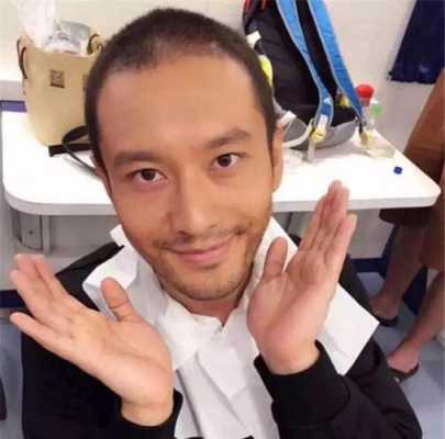 什么叫发际线图片大全（自拍发际线比实际高吗）
