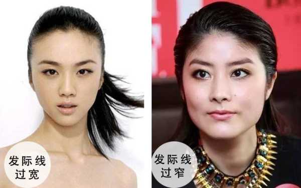 什么叫发际线图片大全（自拍发际线比实际高吗）