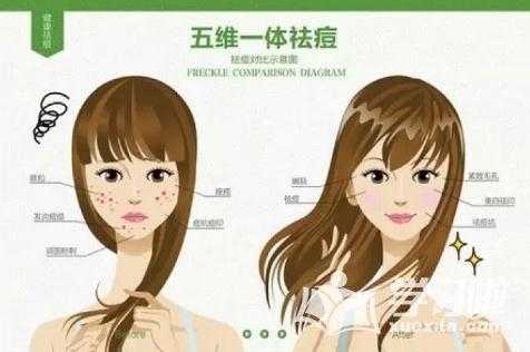 怎么去青春痘小窍门（怎么去青春痘小窍门图片）