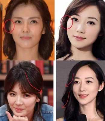 脸颊骨突出是什么脸型（脸颊骨突出是什么脸型图片）