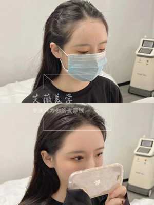额头小头发多怎么办（额头小脸大的怎么改善）