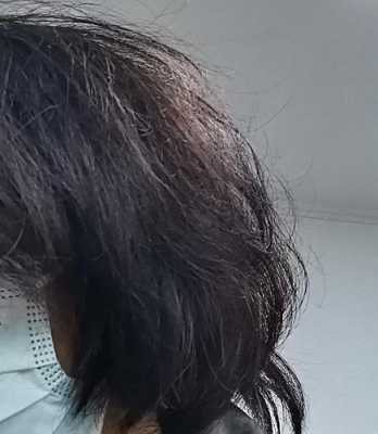 头发洗完后毛糙怎么办（头发洗完后毛糙怎么办啊）