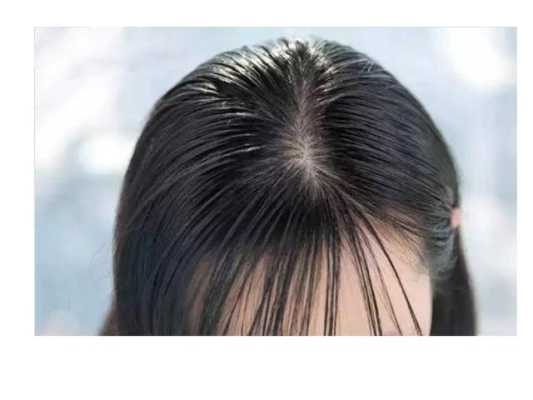 发尾干燥开叉怎么办（头发干枯发叉，怎么解决）
