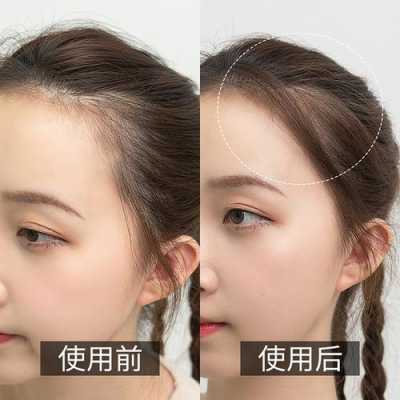 额头前头发少怎么办（额头前头发少怎么办女）