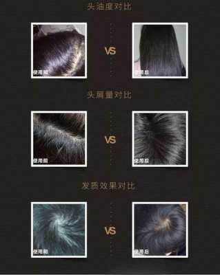 停留在发尾上的头皮屑如何去掉,头皮屑粘在头发上怎么去掉小妙招