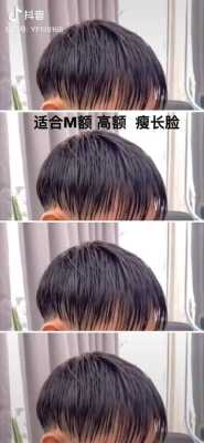 两边发际线太高适合什么发型,发际线两边高怎么办怎么解决