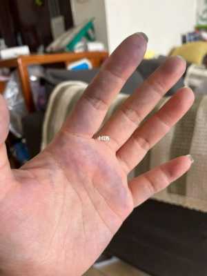 手上弄上染发剂怎么办（染发时手上弄上染发剂怎么办）