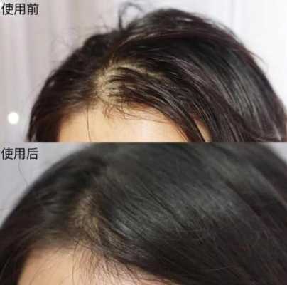 洗头的时候头发掉很多怎么办（洗头的时候头发掉很多怎么办呢）