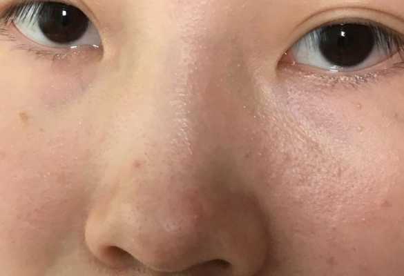 油粒怎么去除最快方法,