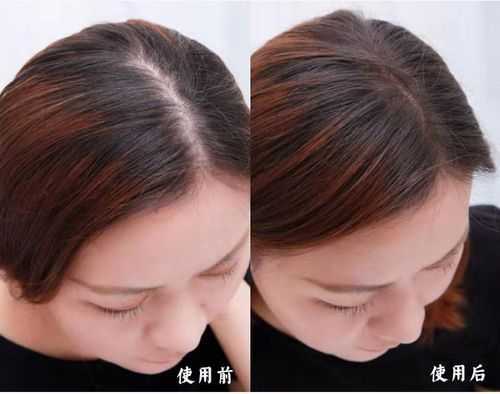 漂头发一拽就断该怎么办,头发断的厉害是什么原因怎么办啊