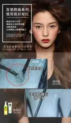 头油怎么解决（头油怎么解决根本问题）