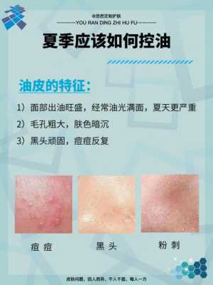 夏季怎么控油（夏天如何控油）